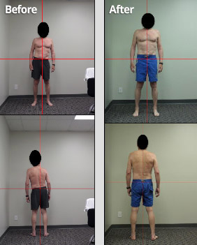 client02-before-and-after-02 - Upright Posture Fitness - Look Younger, Feel  Better and Live Pain Free